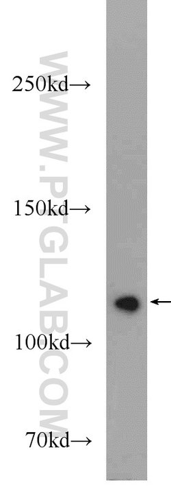PARP1 Rabbit anti-Human, Mouse, Rat, Polyclonal, Proteintech:Antibodies:Primary