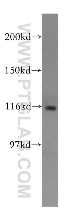 PARP1 Rabbit anti-Human, Mouse, Rat, Polyclonal, Proteintech:Antibodies:Primary