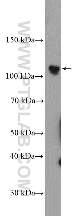 PARP1 Rabbit anti-Human, Mouse, Rat, Polyclonal, Proteintech:Antibodies:Primary