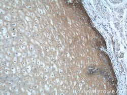 LYNX1 Rabbit anti-Human, Mouse, Rat, Polyclonal, Proteintech 150 &mu;L;