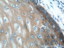 LYNX1 Rabbit anti-Human, Mouse, Rat, Polyclonal, Proteintech 150 &mu;L;