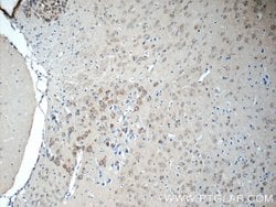 LYNX1 Rabbit anti-Human, Mouse, Rat, Polyclonal, Proteintech 150 &mu;L;