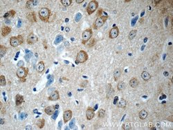 LYNX1 Rabbit anti-Human, Mouse, Rat, Polyclonal, Proteintech 150 &mu;L;