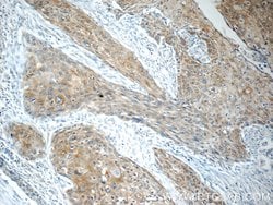 LYNX1 Rabbit anti-Human, Mouse, Rat, Polyclonal, Proteintech 150 &mu;L;