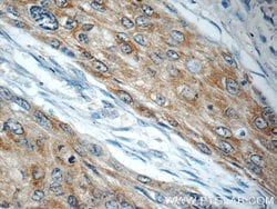 LYNX1 Rabbit anti-Human, Mouse, Rat, Polyclonal, Proteintech 150 &mu;L;