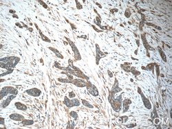 IFIT5 Rabbit anti-Human, Polyclonal, Proteintech:Antibodies:Primary Antibodies
