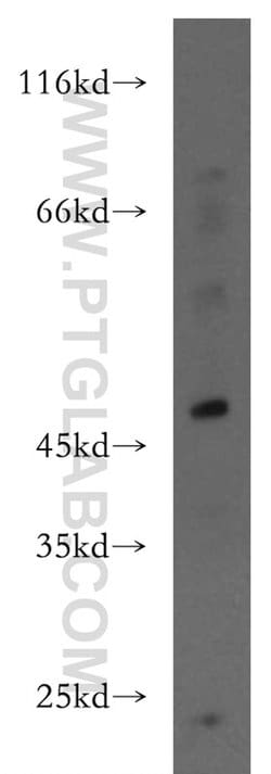 IFIT5 Rabbit anti-Human, Polyclonal, Proteintech:Antibodies:Primary Antibodies