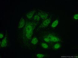 GLRX2 Rabbit anti-Human, Mouse, Rat, Polyclonal, Proteintech:Antibodies:Primary