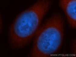 NCAPD2 Rabbit anti-Human, Mouse, Rat, Polyclonal, Proteintech 150 &mu;L;