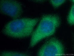 NCAPD2 Rabbit anti-Human, Mouse, Rat, Polyclonal, Proteintech 150 &mu;L;