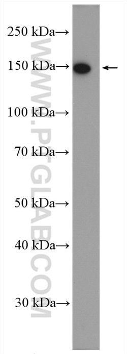 NCAPD2 Rabbit anti-Human, Mouse, Rat, Polyclonal, Proteintech 150 &mu;L;