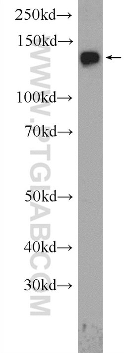 NCAPD2 Rabbit anti-Human, Mouse, Rat, Polyclonal, Proteintech 150 &mu;L;