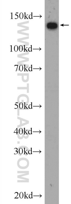 NCAPD2 Rabbit anti-Human, Mouse, Rat, Polyclonal, Proteintech 150 &mu;L;