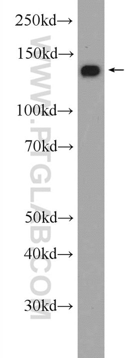 NCAPD2 Rabbit anti-Human, Mouse, Rat, Polyclonal, Proteintech 150 &mu;L;