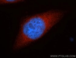 HSPH1 Rabbit anti-Human, Polyclonal, Proteintech:Antibodies:Primary Antibodies