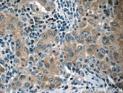 HSPH1 Rabbit anti-Human, Polyclonal, Proteintech:Antibodies:Primary Antibodies