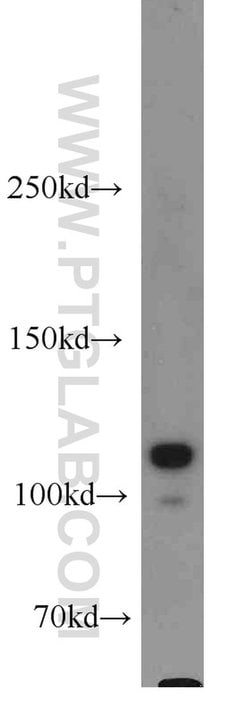 HSPH1 Rabbit anti-Human, Polyclonal, Proteintech:Antibodies:Primary Antibodies