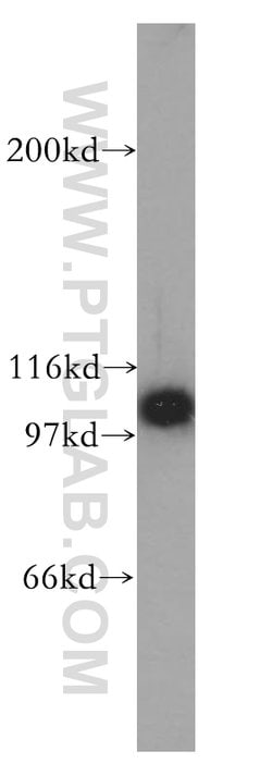 HSPH1 Rabbit anti-Human, Polyclonal, Proteintech:Antibodies:Primary Antibodies