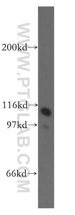 HSPH1 Rabbit anti-Human, Polyclonal, Proteintech:Antibodies:Primary Antibodies