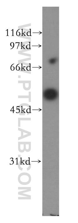 CPN1 Rabbit anti-Human, Mouse, Rat, Polyclonal, Proteintech 150 &mu;L;
