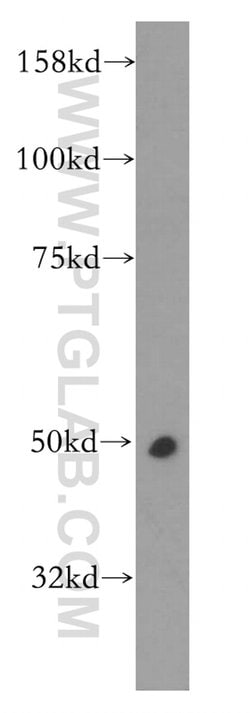 CPN1 Rabbit anti-Human, Mouse, Rat, Polyclonal, Proteintech 150 &mu;L;
