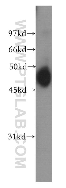 CCRL2 Rabbit anti-Human, Mouse, Polyclonal, Proteintech 150 &mu;L; Unconjugated:Antibodies,