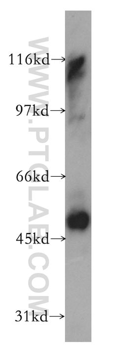 CCRL2 Rabbit anti-Human, Mouse, Polyclonal, Proteintech 150 &mu;L; Unconjugated:Antibodies,