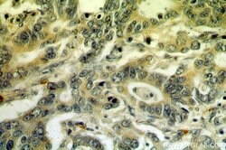 IHH Rabbit anti-Human, Mouse, Rat, Polyclonal, Proteintech:Antibodies:Primary