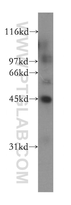 IHH Rabbit anti-Human, Mouse, Rat, Polyclonal, Proteintech:Antibodies:Primary