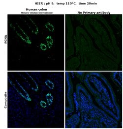 Invitrogen PCNA Monoclonal Antibody (PC10) 200 &mu;g; Unconjugated:Antibodies,