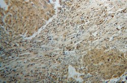 CLEC1A Rabbit anti-Human, Mouse, Rat, Polyclonal, Proteintech:Antibodies:Primary