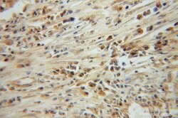 CLEC1A Rabbit anti-Human, Mouse, Rat, Polyclonal, Proteintech:Antibodies:Primary