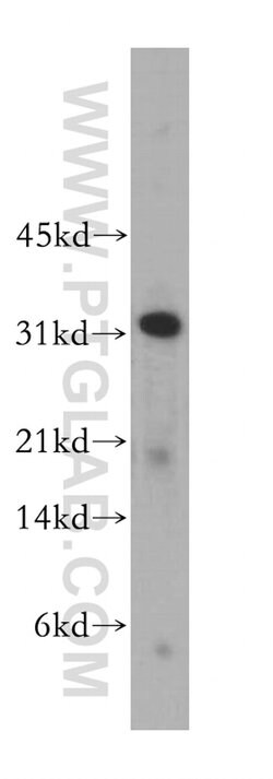 CLEC1A Rabbit anti-Human, Mouse, Rat, Polyclonal, Proteintech:Antibodies:Primary