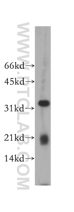 CLEC1A Rabbit anti-Human, Mouse, Rat, Polyclonal, Proteintech:Antibodies:Primary