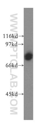 Thumbnail_CD86 Rabbit anti-Human, Polyclonal, Proteintech:Anticuerpos:Anticuerpos