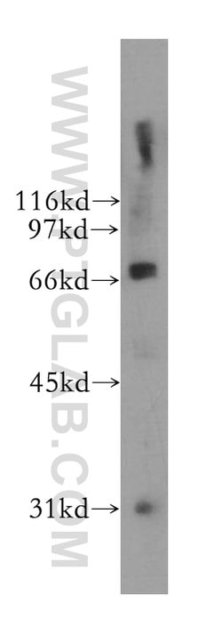 B4GALNT1 Rabbit anti-Human, Polyclonal, Proteintech:Antibodies:Primary