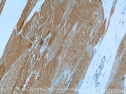 PHKB Rabbit anti-Human, Mouse, Polyclonal, Proteintech 150 &mu;L; Unconjugated:Antibodies,