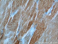 PHKB Rabbit anti-Human, Mouse, Polyclonal, Proteintech 150 &mu;L; Unconjugated:Antibodies,
