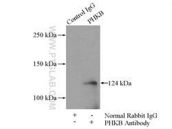 PHKB Rabbit anti-Human, Mouse, Polyclonal, Proteintech