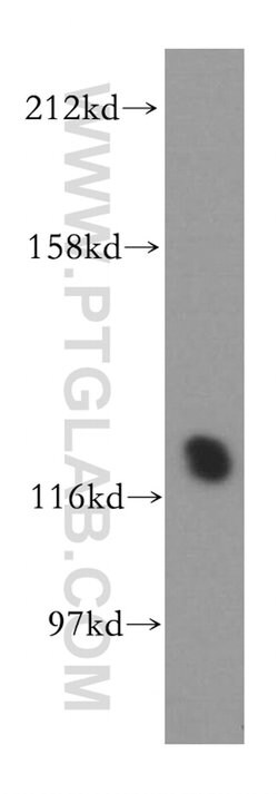 PHKB Rabbit anti-Human, Mouse, Polyclonal, Proteintech 150 &mu;L; Unconjugated:Antibodies,