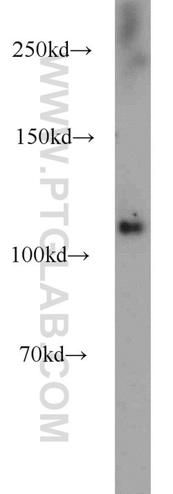 PHKB Rabbit anti-Human, Mouse, Polyclonal, Proteintech 150 &mu;L; Unconjugated:Antibodies,