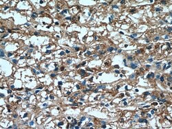 TRIM38 Rabbit anti-Human, Polyclonal, Proteintech 150 &mu;L; Unconjugated:Antibodies,