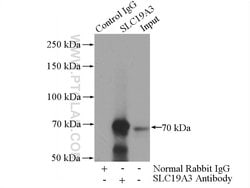SLC19A3 Rabbit anti-Human, Mouse, Rat, Polyclonal, Proteintech:Antibodies:Primary