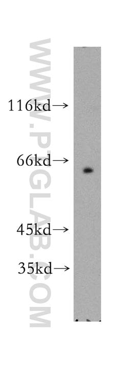 SLC19A3 Rabbit anti-Human, Mouse, Rat, Polyclonal, Proteintech:Antibodies:Primary
