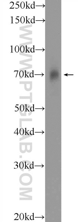 SLC19A3 Rabbit anti-Human, Mouse, Rat, Polyclonal, Proteintech:Antibodies:Primary