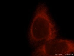 TRPV6 Rabbit anti-Human, Mouse, Rat, Polyclonal, Proteintech:Antibodies:Primary