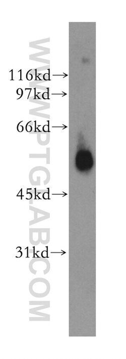 GPR17 Rabbit anti-Human, Mouse, Rat, Polyclonal, Proteintech:Antibodies:Primary