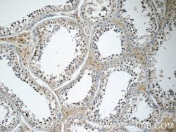 MED19 Rabbit anti-Human, Mouse, Rat, Polyclonal, Proteintech:Antibodies:Primary