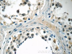 MED19 Rabbit anti-Human, Mouse, Rat, Polyclonal, Proteintech:Antibodies:Primary