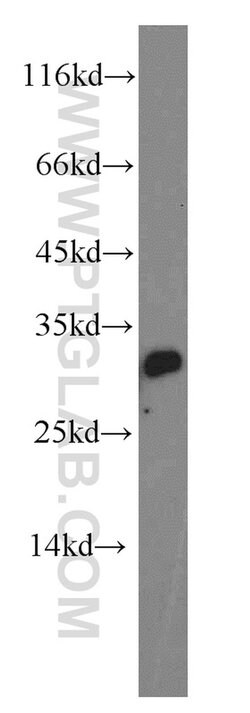 MED19 Rabbit anti-Human, Mouse, Rat, Polyclonal, Proteintech:Antibodies:Primary
